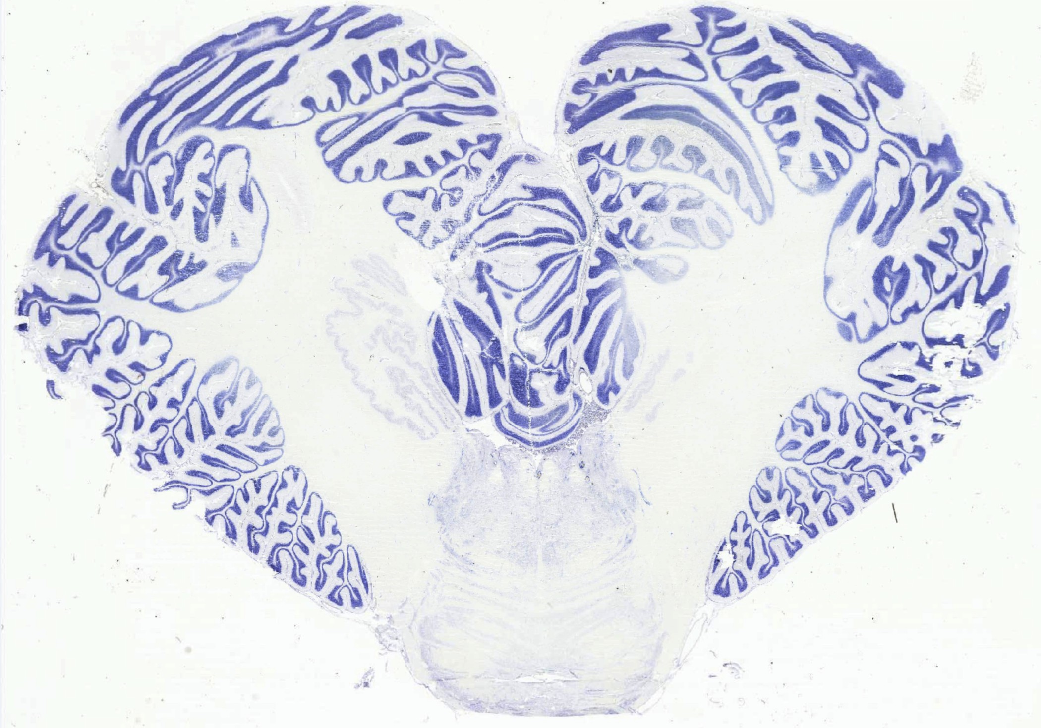 Adult Human Brain Cerebellum Nissil stain